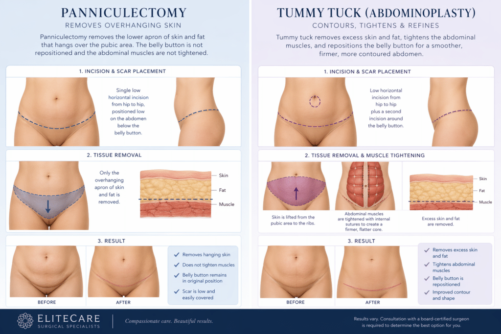 Infographic explaining the difference between a panniculectomy and tummy tuck